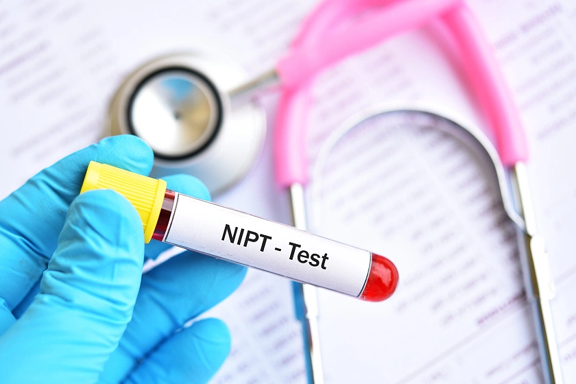 Laborröhrchen mit Blut und der Aufschrift NIPT Test